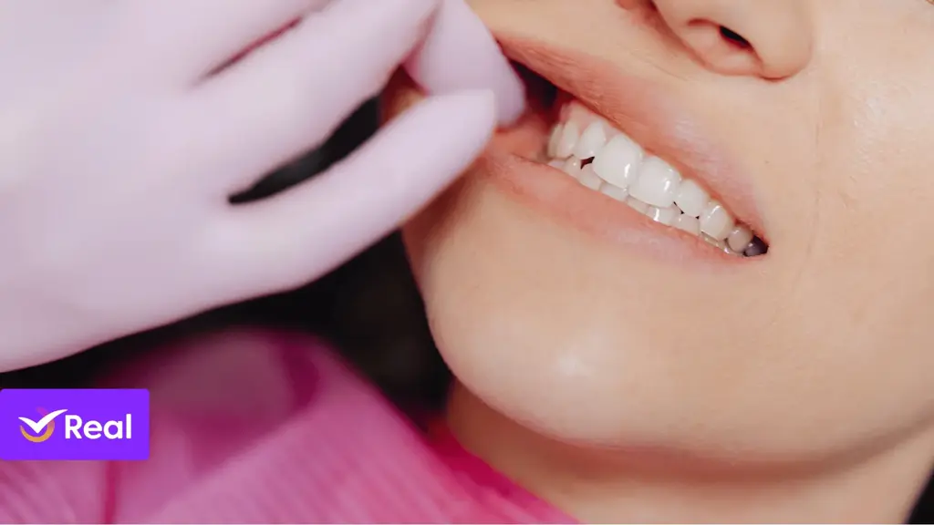 imagem capa do post Quebrei o dente na viagem: o que fazer agora?